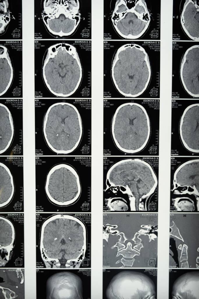 Keurend arts bespreekt CBR neuroloog keuring met keurling in een heldere spreekkamer