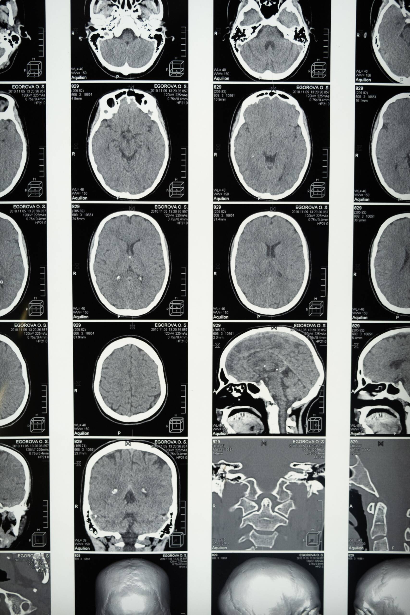 Keurend arts bespreekt CBR neuroloog keuring met keurling in een heldere spreekkamer